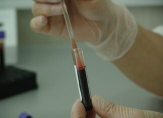 Coronavirus, in Toscana 113 casi e 41 guarigioni in più rispetto a ieri, nessun decesso