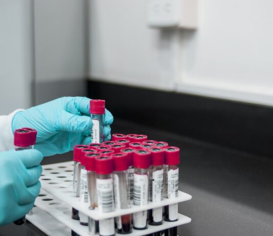 Coronavirus, al via il nuovo portale web per la consultazione rapida dei risultati