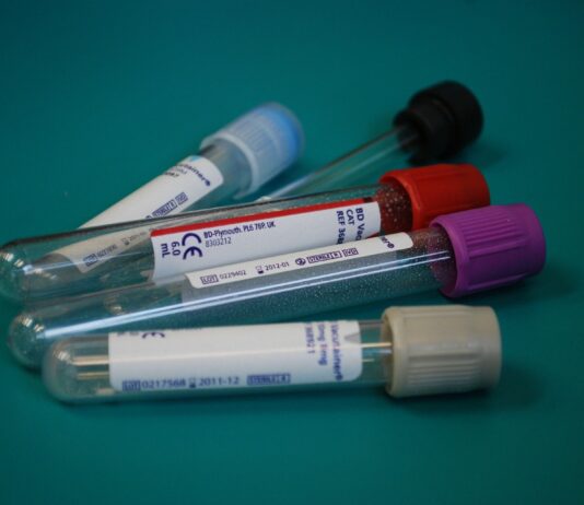 Coronavirus: in Toscana 156 nuovi casi, nessun decesso, 54 guarigioni