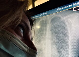Covid-19: vedere il Virus attraverso i Raggi X