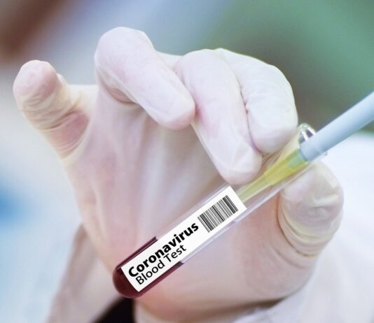 Coronavirus, 103 nuovi casi nell’aretino