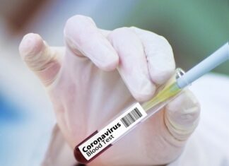 Coronavirus, 44 nuovi casi nell’aretino