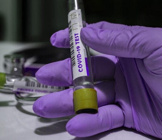 Coronavirus, 64 nuovi casi nell’aretino