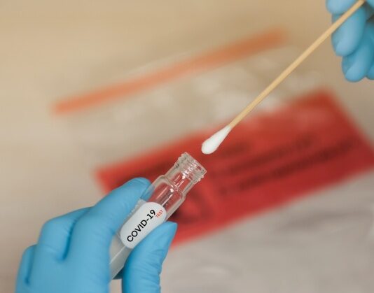 Coronavirus: 20 nuovi casi nell’aretino, 51 in degenza covid, 14 in terapia intensiva, 13 guariti, 0 decessi