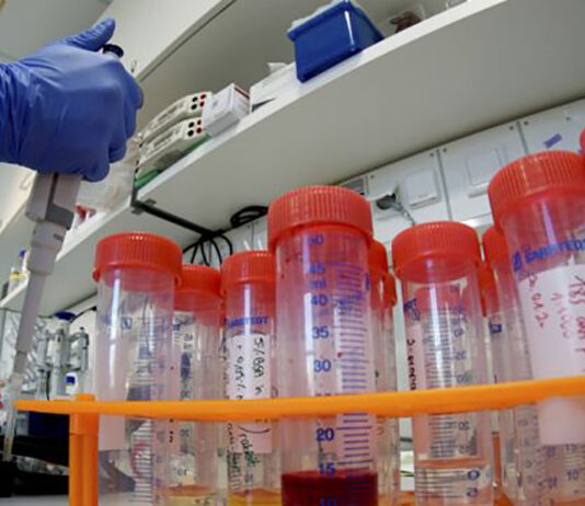 Coronavirus: 11 nuovi casi nell’aretino, 2 persone in degenza covid