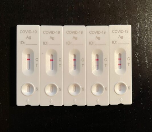 Coronavirus: 600 nuovi casi nell’aretino, 21 persone in degenza covid, 1 in terapia intensiva, 2 decessi