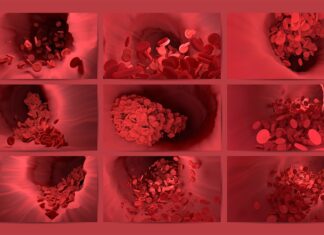 Trombocitopenia trombotica immunitaria indotta da vaccino Pfizer? Nuovo studio pubblicato il 5 agosto 2022