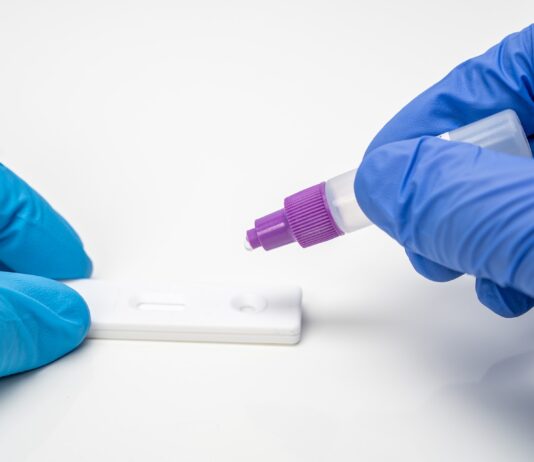 Coronavirus: in Toscana 285 nuovi casi e 2 decessi, di 83 anni d’età media